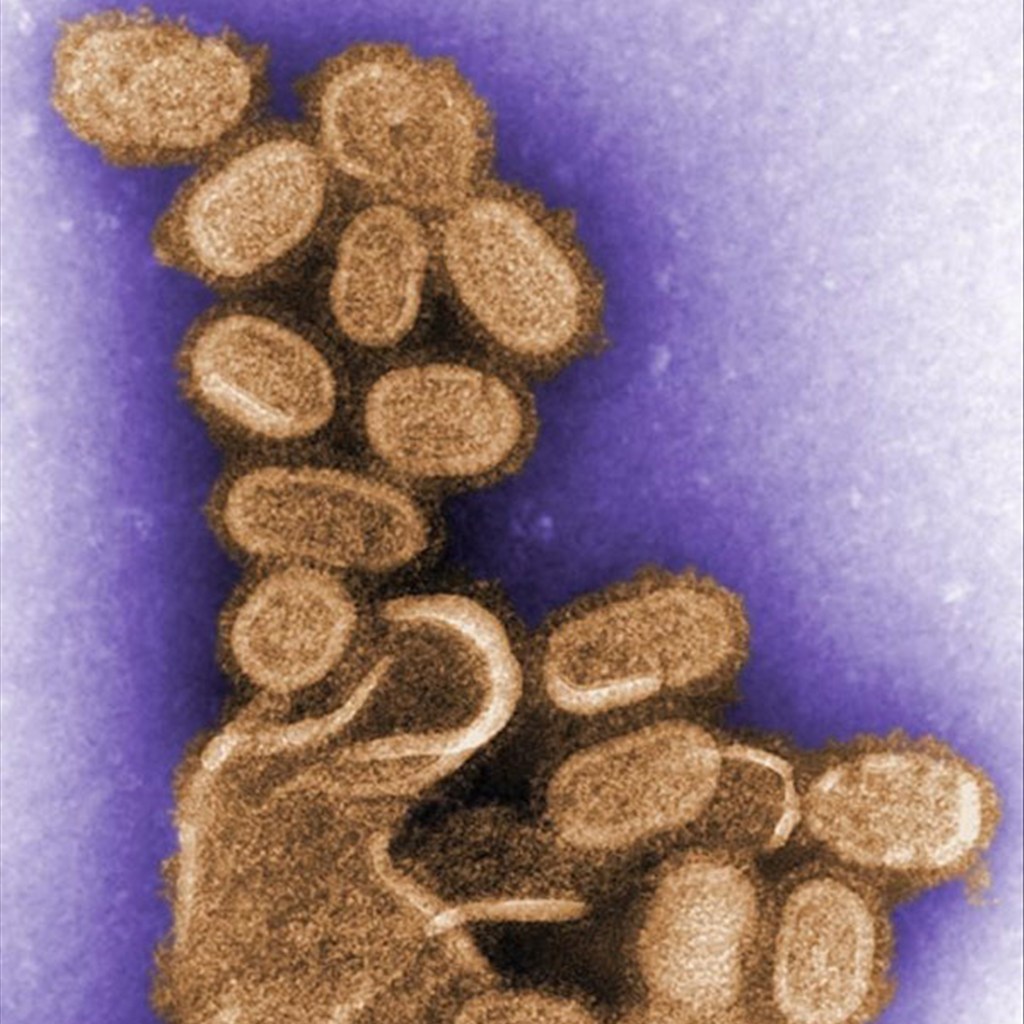 1918年H1N1インフルエンザウイルス粒子の電子顕微鏡像